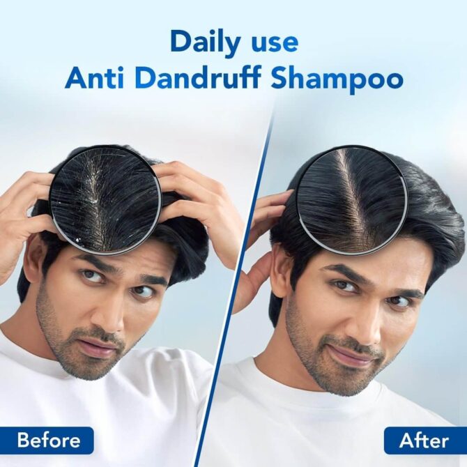 anti dandruff shampoo for women & men